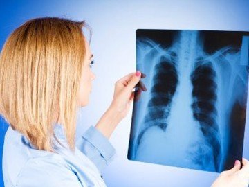 О профилактике туберкулеза